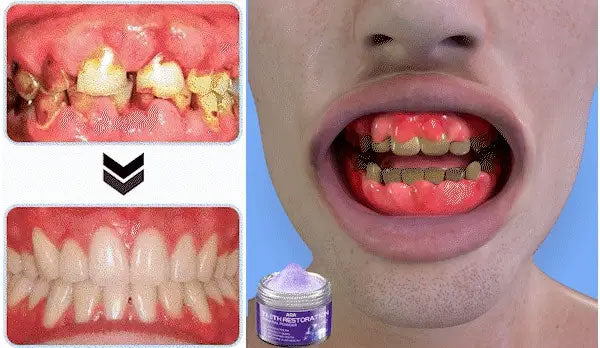 AQA TeethRestoration Mineral Powder🦷(CDA recommended) (🎁Flash Sale - Don’t Miss Out)