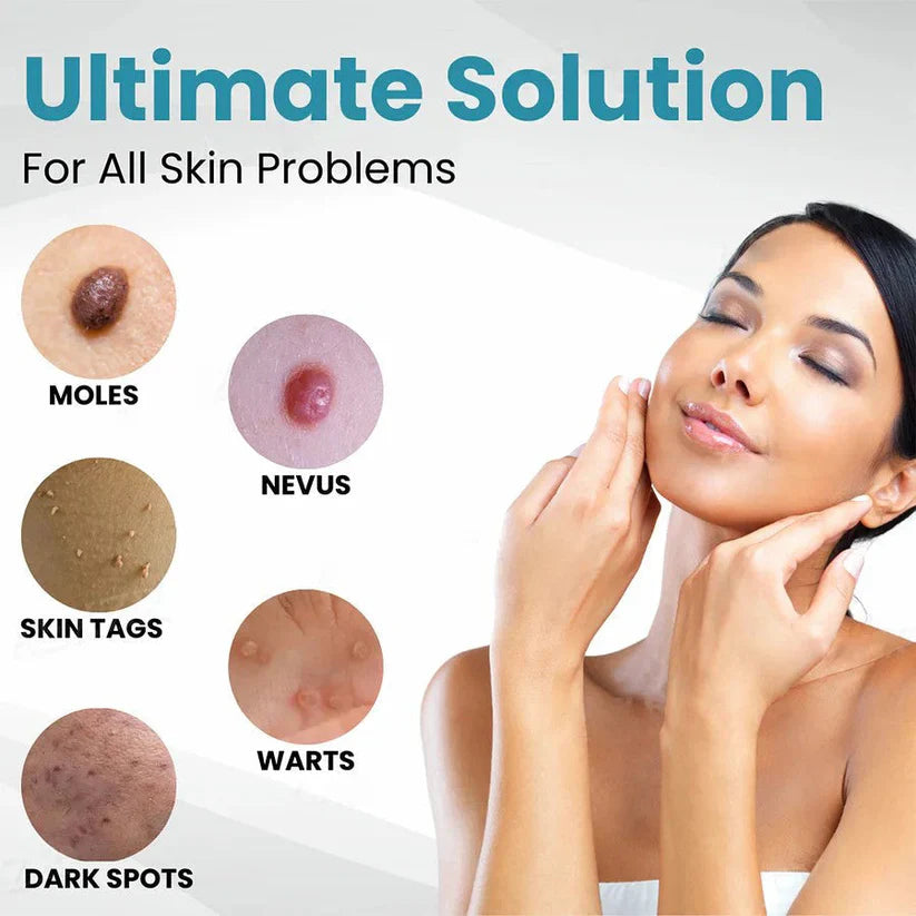 LOVILDS™ Non-Invasive Mole and Wart Removal Laser Pen
